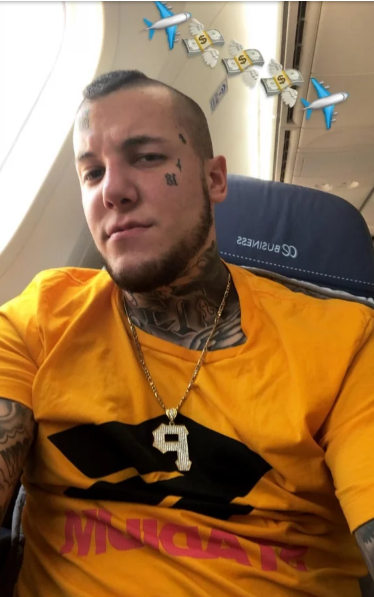 Alexander Caniggia se operó la nariz y mostró por primera vez el resultado