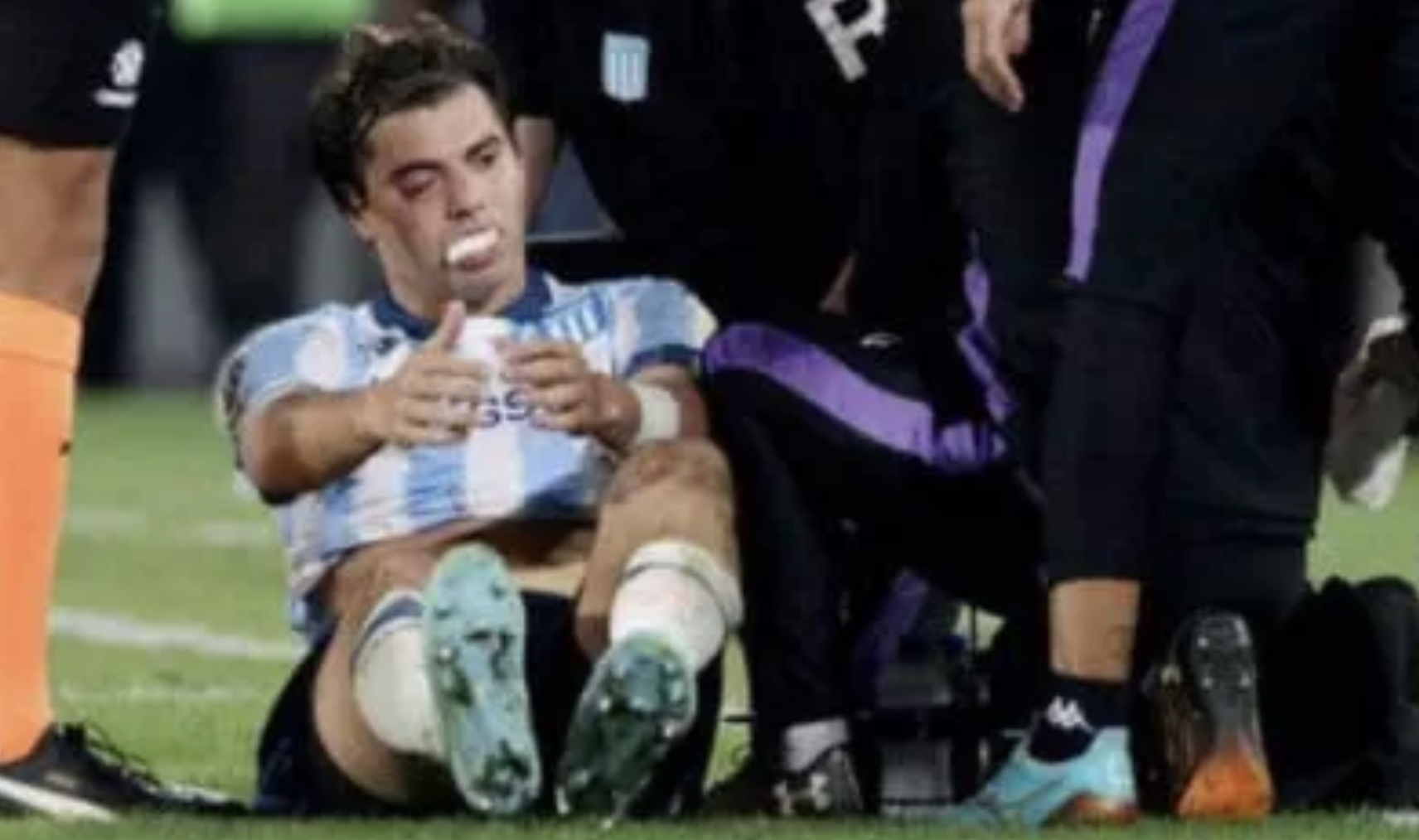 Sosa sufrió una fractura por el codazo de Rojo y tendrá que ser operado