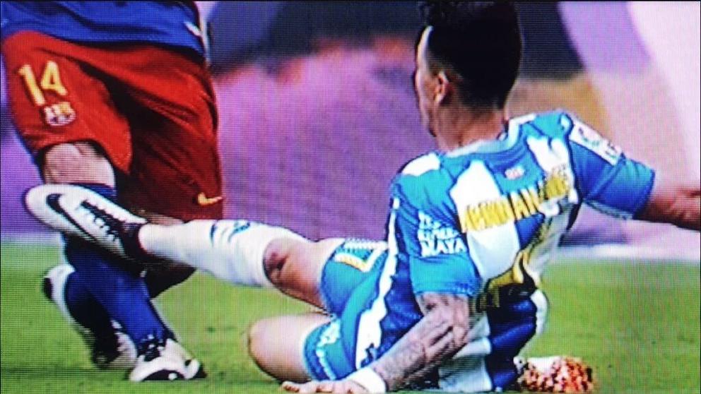 Dura entrada a Masche